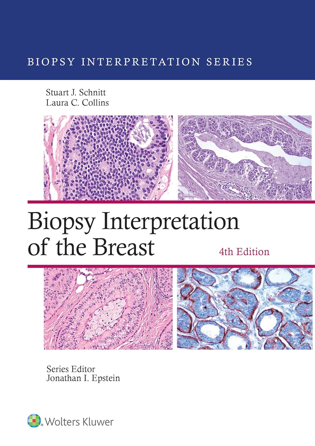 Biopsy Interpretation of the Breast (Biopsy Interpretation Series), 4th Edition