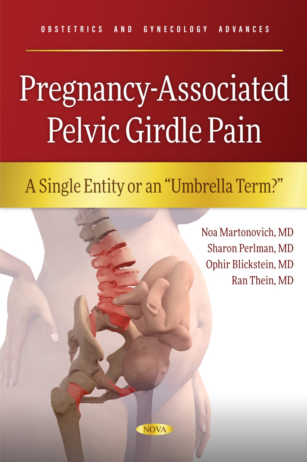 Pregnancy-Associated Pelvic Girdle Pain: A Single Entity or an “Umbrella Term?"