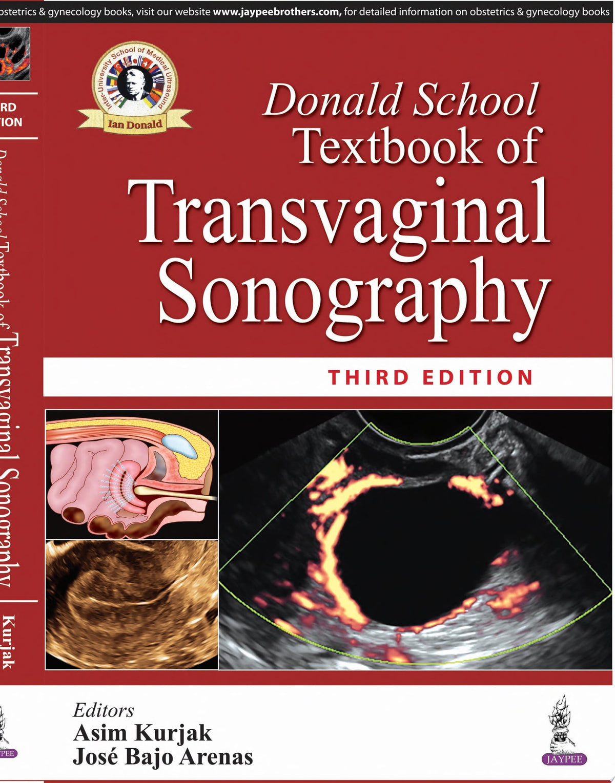 Donald School Textbook of Transvaginal Sonography, 3rd Edition