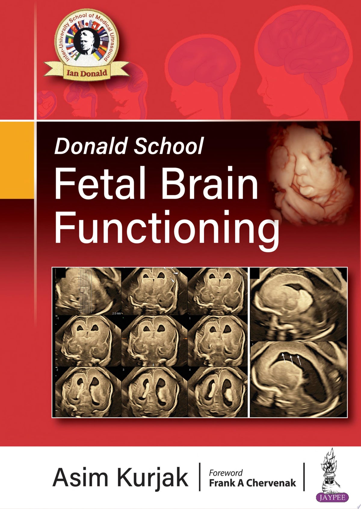 Donald School Fetal Brain Functioning