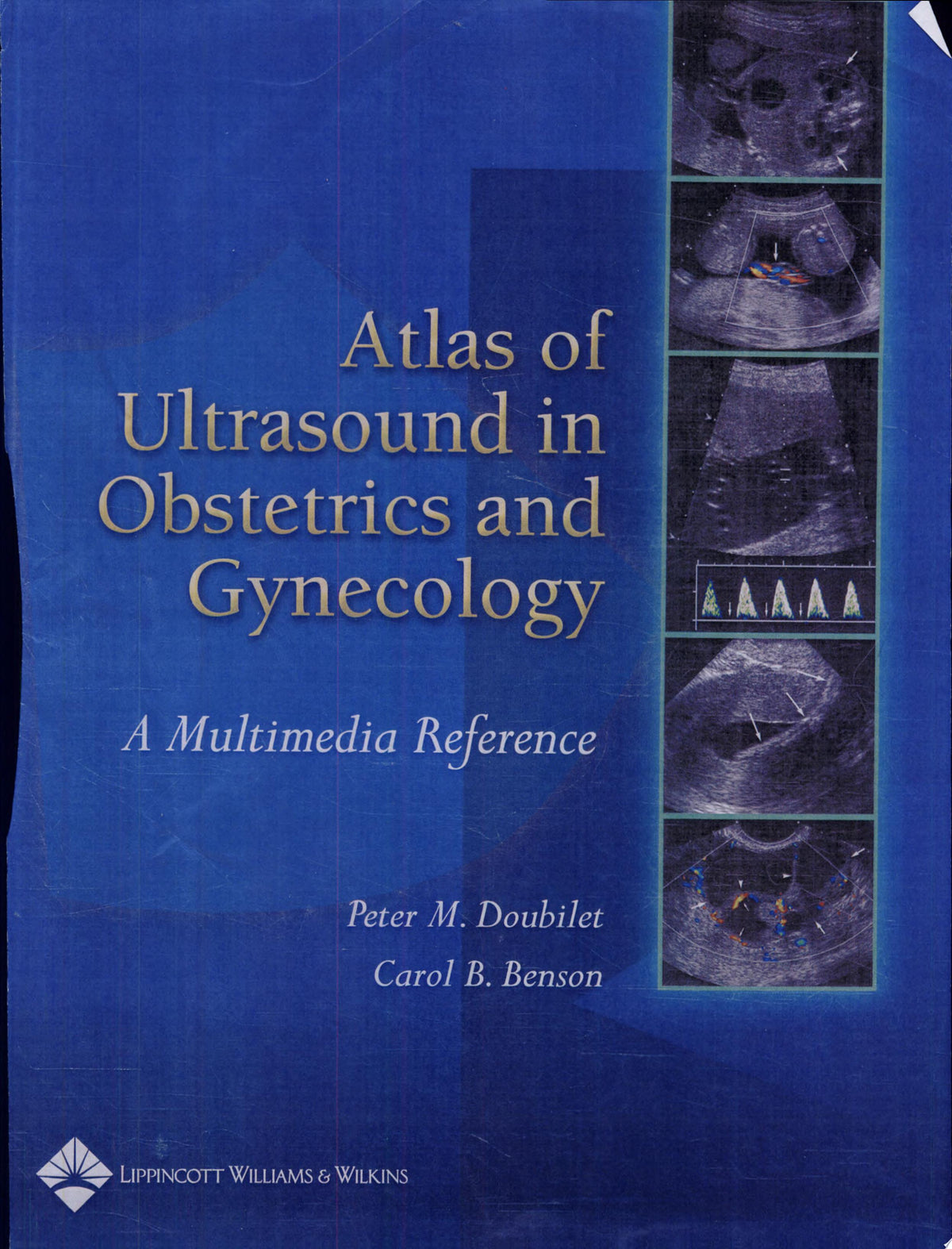 Atlas of Ultrasound in Obstetrics and Gynecology: A Multimedia Reference, 2nd Edition