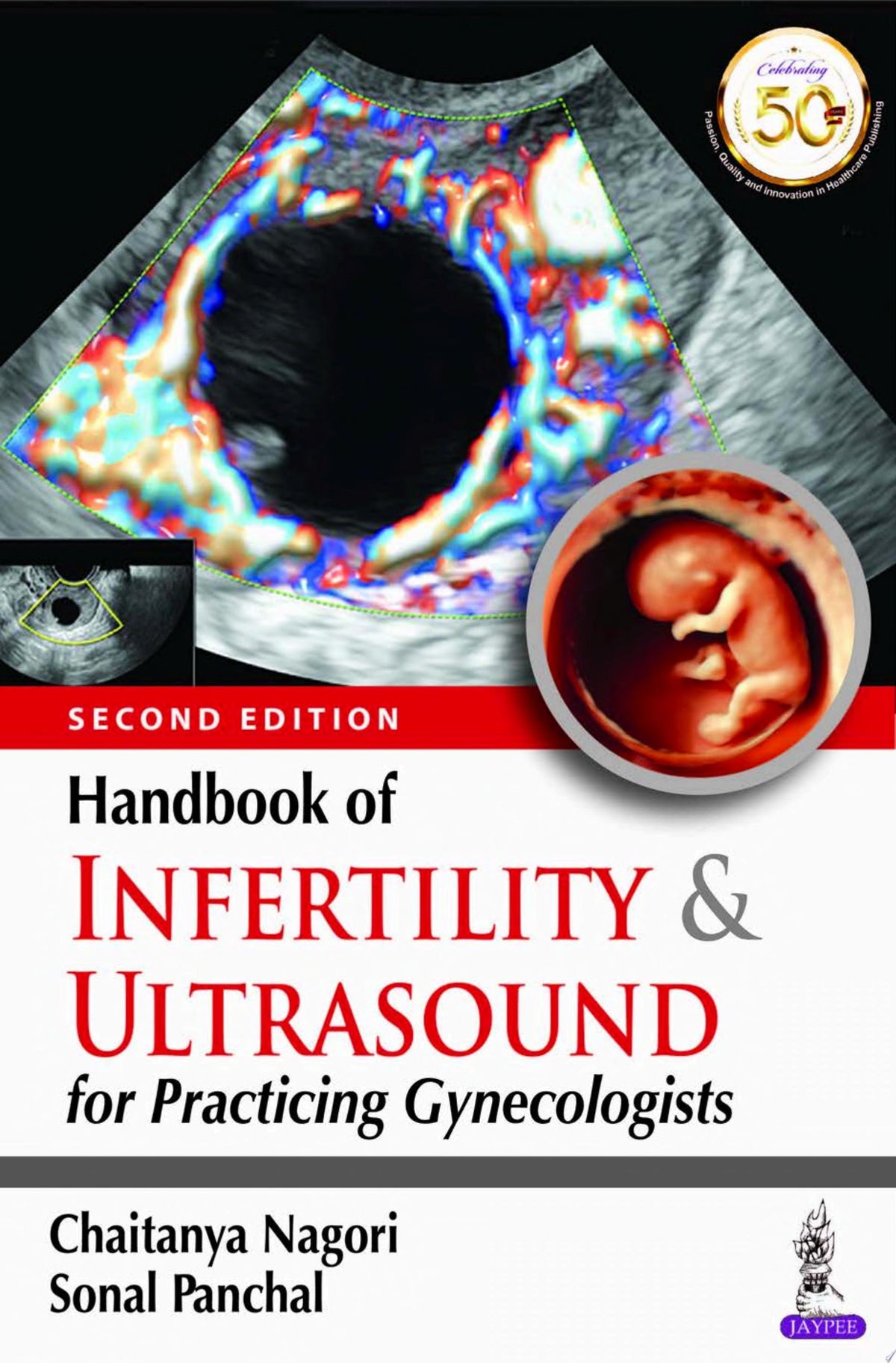 Handbook of Infertility & Ultrasound for Practicing Gynecologists, 2nd Edition