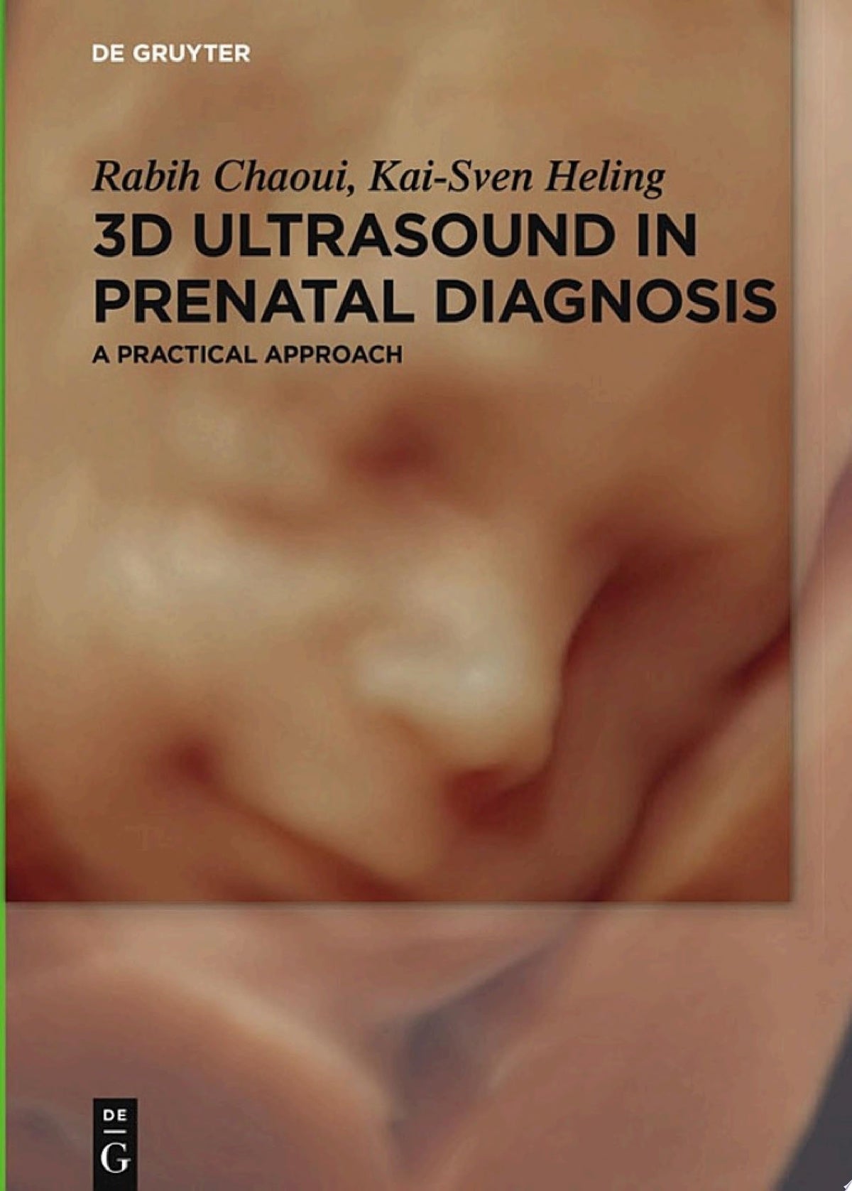 3D Ultrasound in Prenatal Diagnosis: A Practical Approach