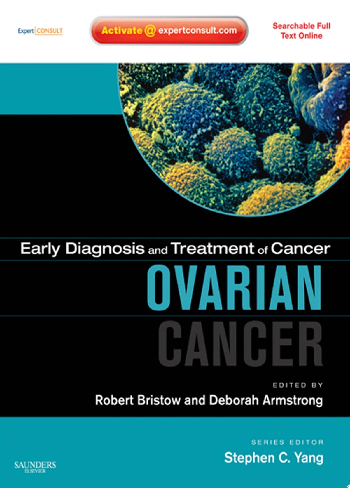 Early Diagnosis and Treatment of Cancer: Ovarian Cancer