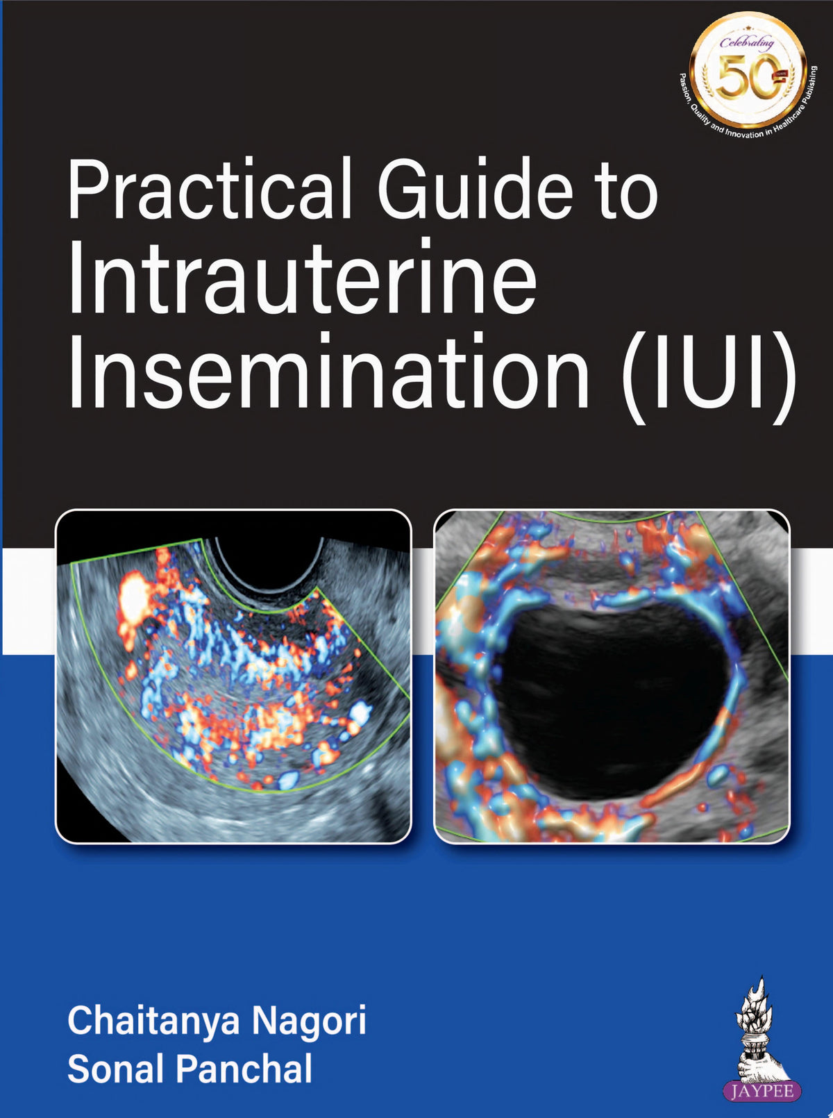 Practical Guide To Intrauterine Insemination