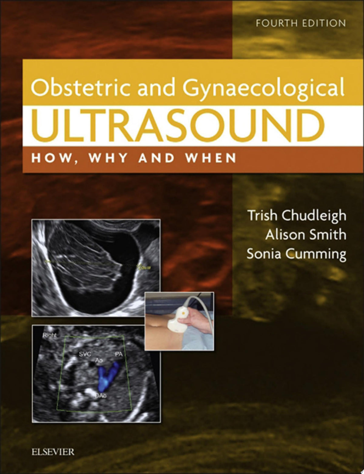 Obstetric & Gynaecological Ultrasound: How, Why and When