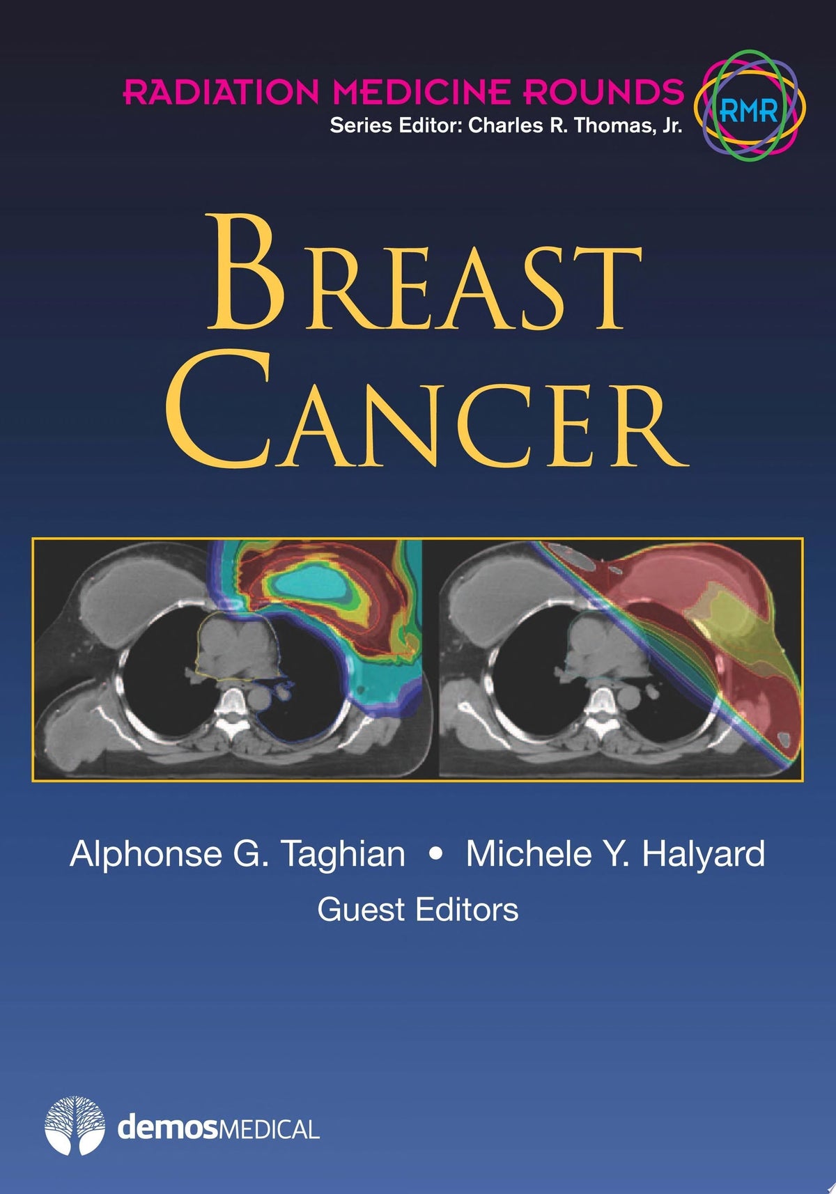 Breast Cancer: A Multidisciplinary Approach