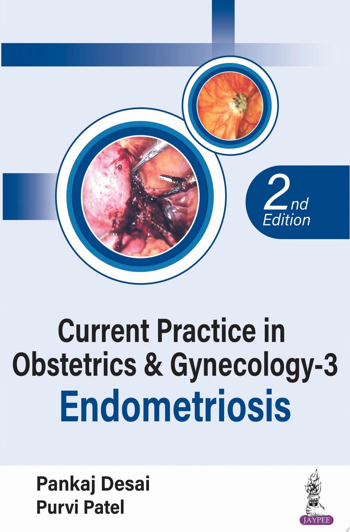Current Practice in Obstetrics & Gynecology – 3: Endometriosis