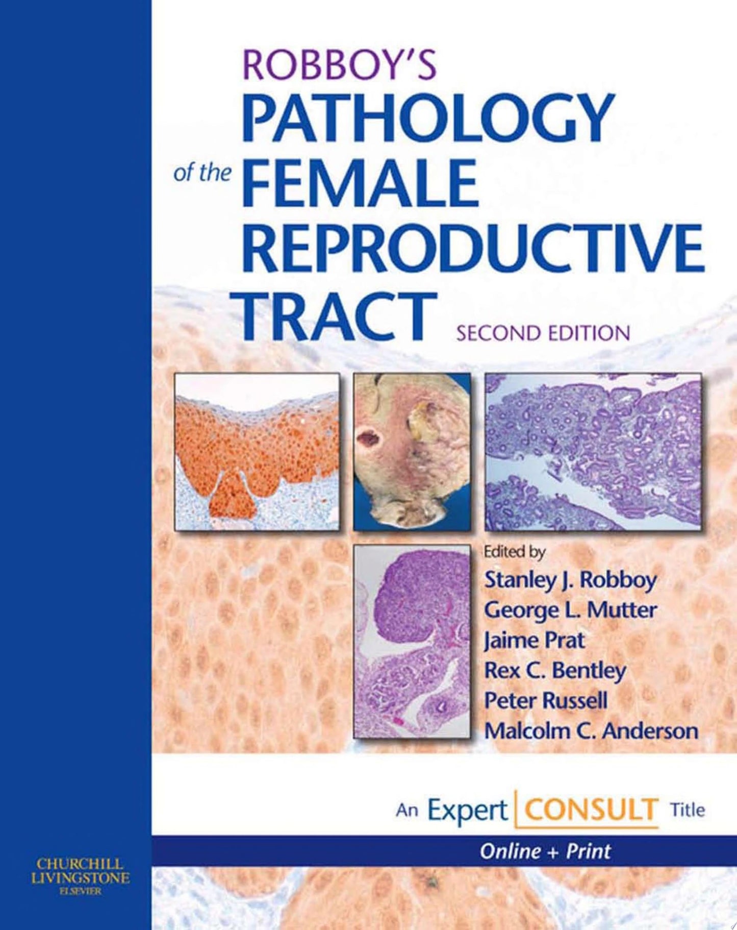 WHO Classification of Tumours of the Female Reproductive Organs