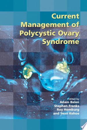 Current Management of Polycystic Ovary Syndrome