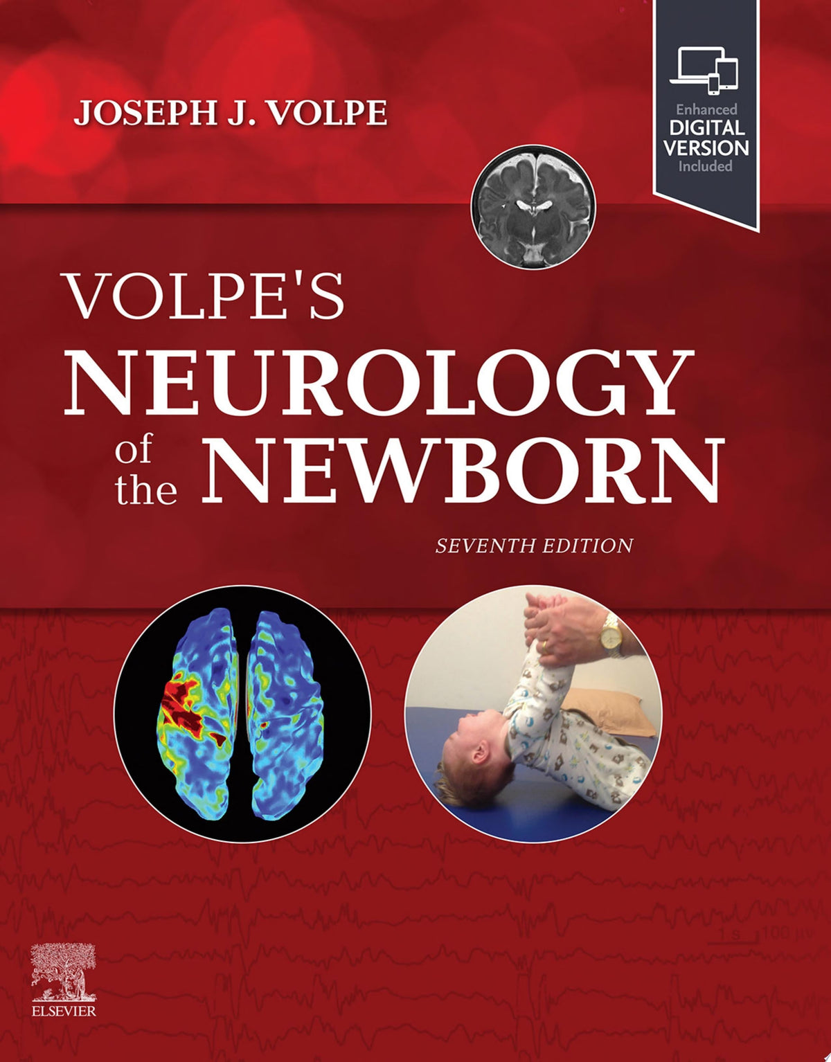 Volpe’s Neurology of the Newborn, 7th Edition