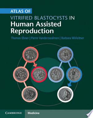 Atlas of Vitrified Blastocysts in Human Assisted Reproduction