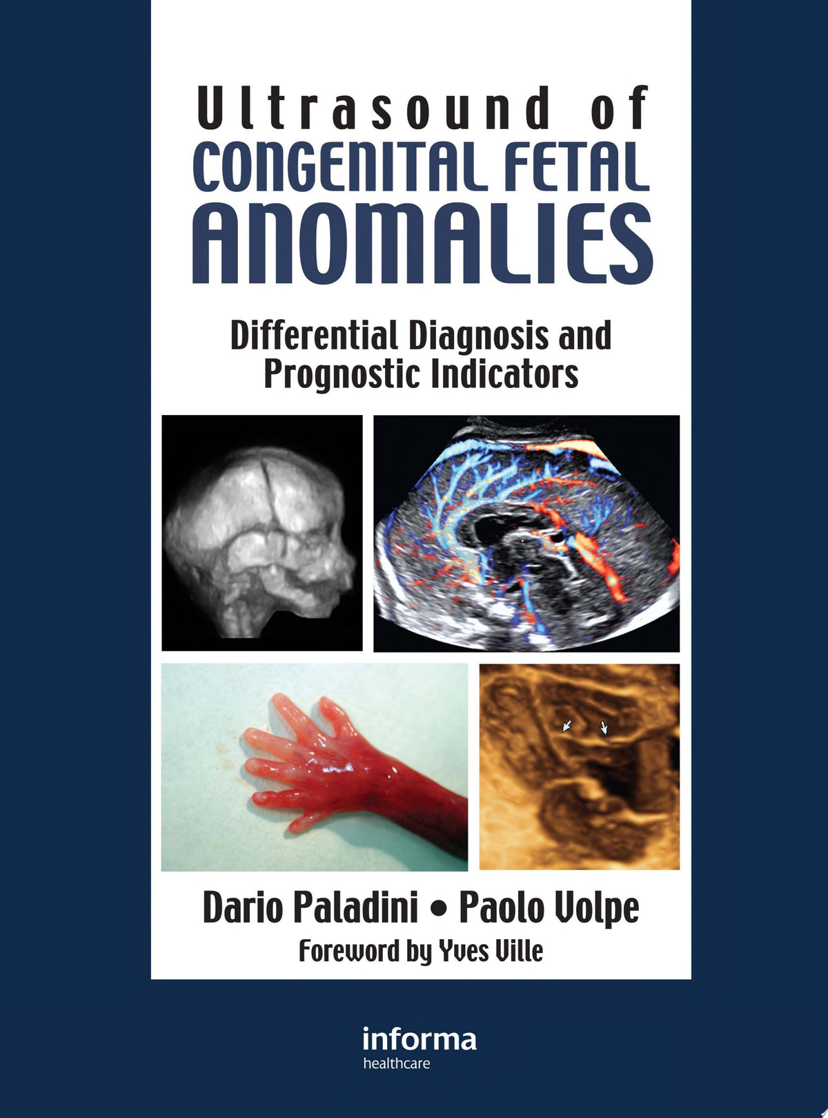 Ultrasound for Congenital Fetal Anomalies