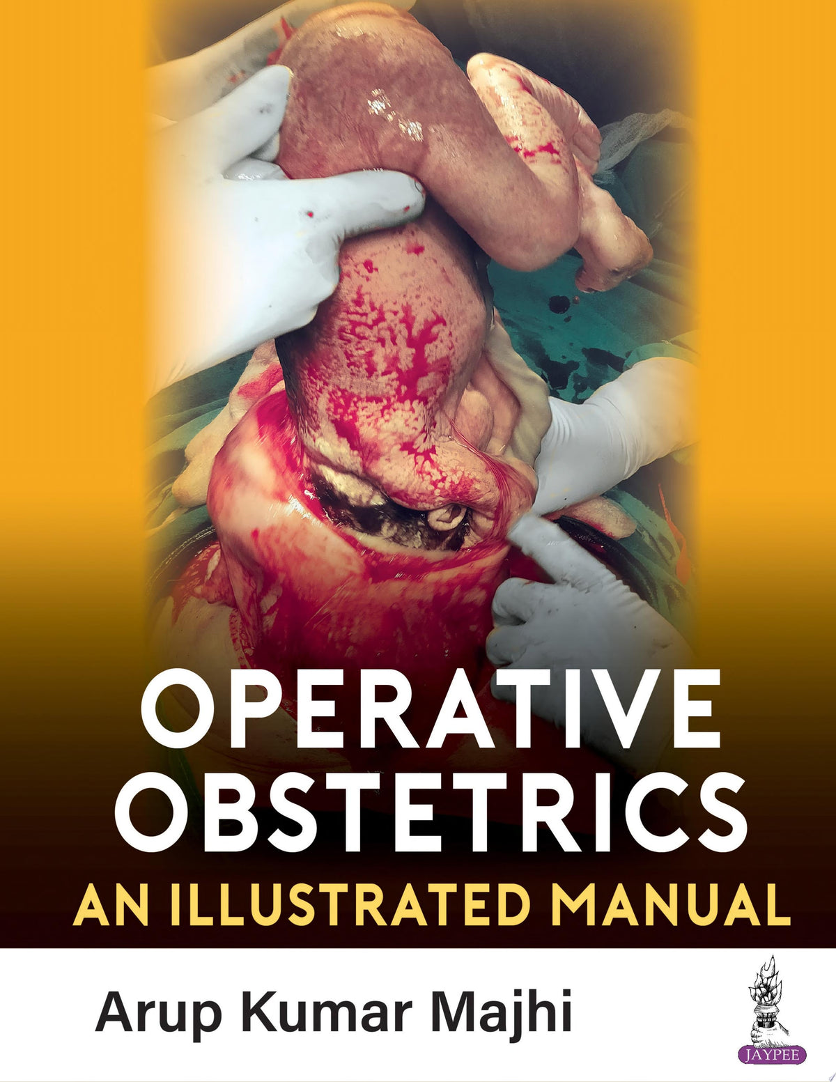 Operative Obstetrics: An Illustrated Manual