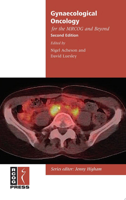 Management of Infertility for the MRCOG and Beyond, 3rd Edition