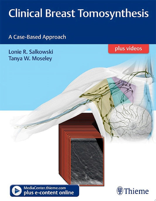 Clinical Breast Tomosynthesis: A Case-Based Approach